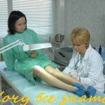 Все о варикозе.