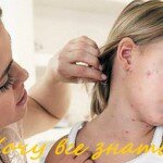 Корь - инфекционное заболевание