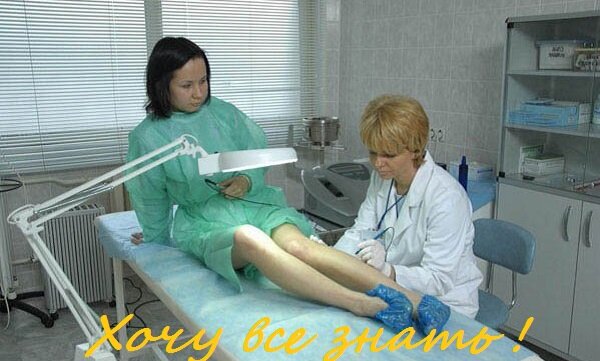 Все о варикозе.